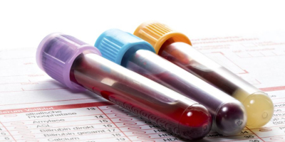 Список бесплатных анализов по ОМС в 2023 году